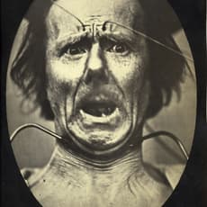 Guillaume Benjamin Armand Duchenne de Boulogne