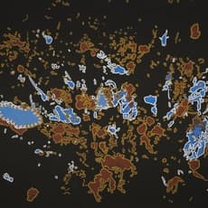 Linda Syddick Napaltjarri